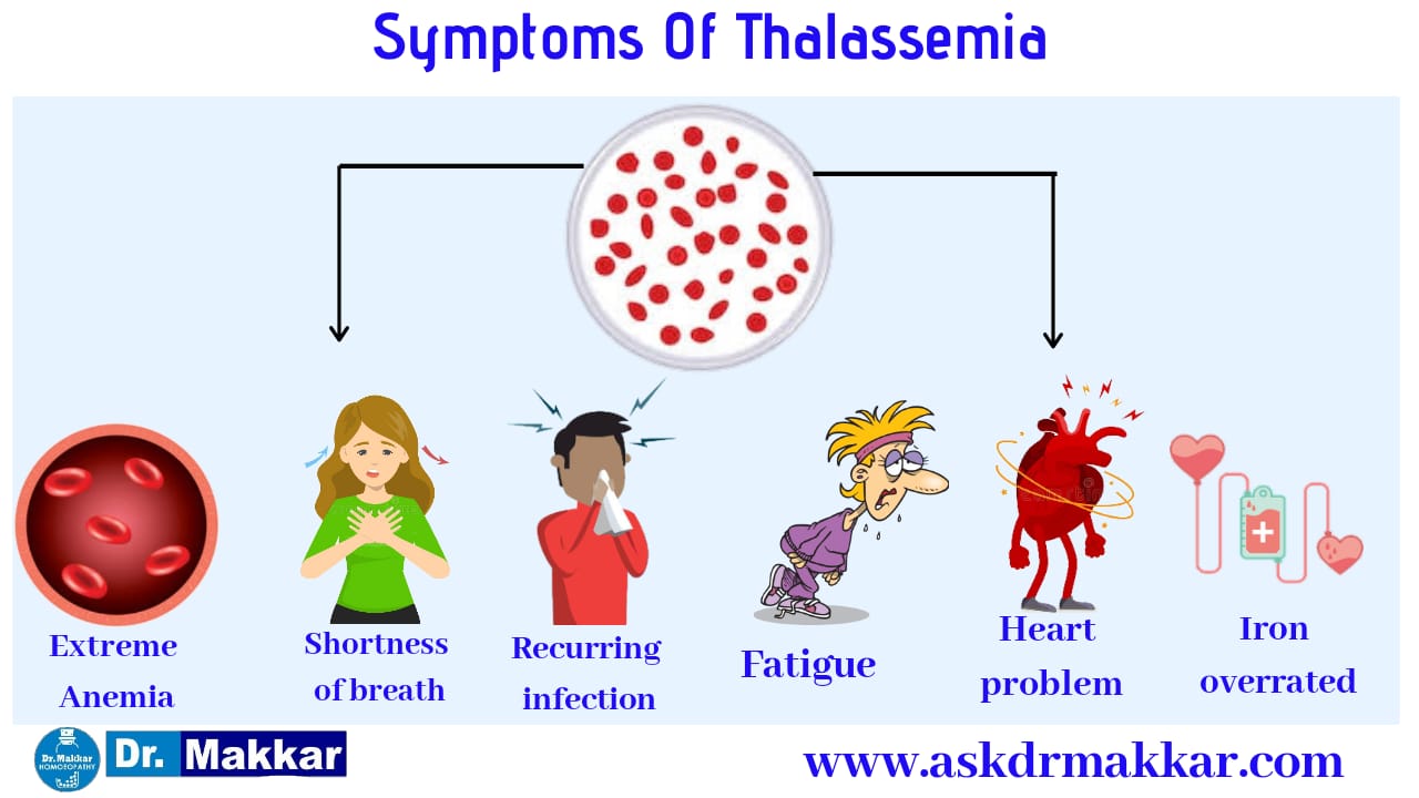 Understanding Thalassemia Anemia Causes Symptoms And Treatment Hot Sex Picture 1889
